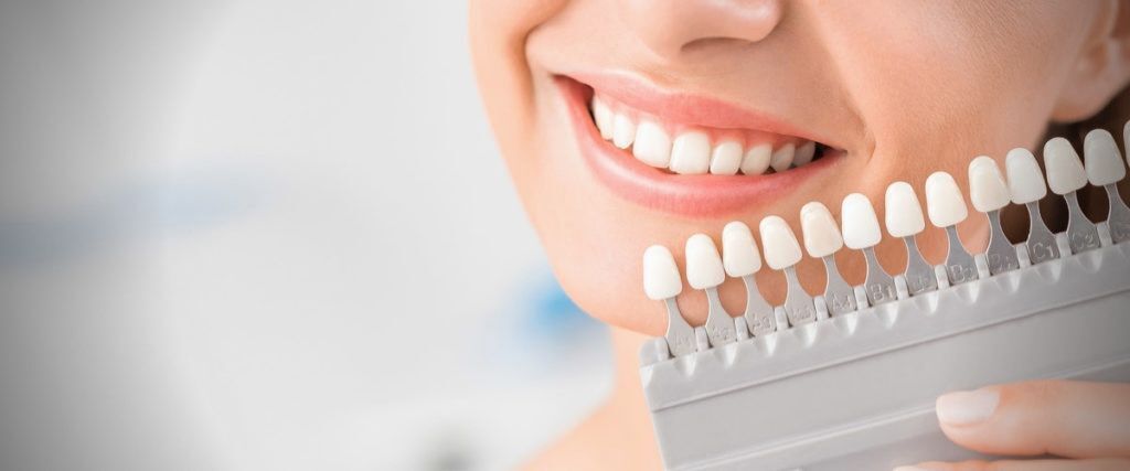 Lente de Contato Dental